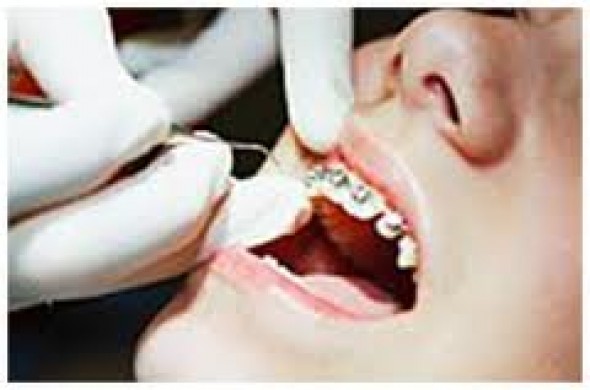 Serviços odontológicos relacionados à ortodontia e a obrigação de resultado
